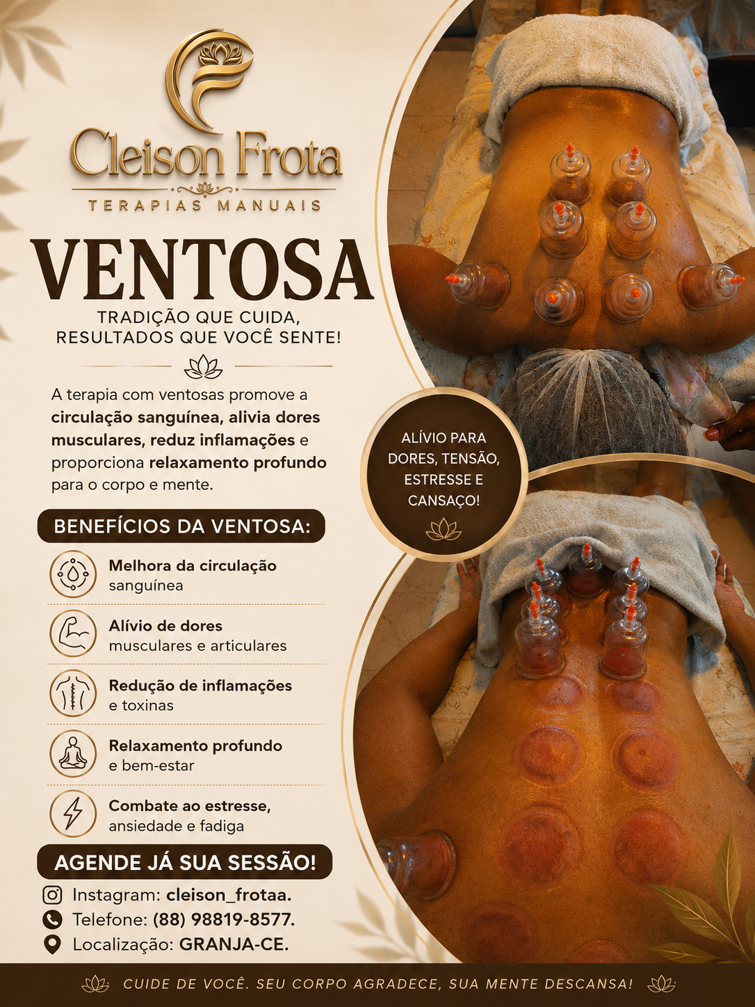 2 - VENTOSAS
